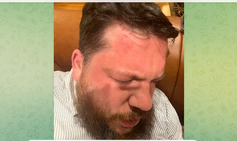 Alexey Navalny Yolsuzlukla Mücadele Vakfı