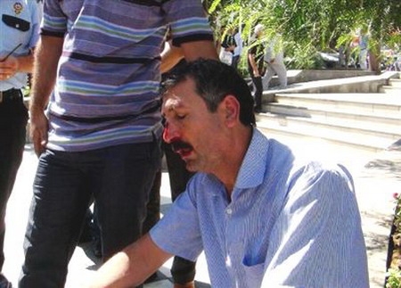 Başkan Fakıbaba`ya Saldırdı, Güvenlikten Öldüresiye Dayak Yedi